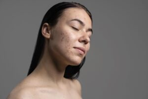 korean toners for acne